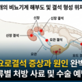 강아지 요로결석 증상 원인 결석 종류별 처방 수술 예방